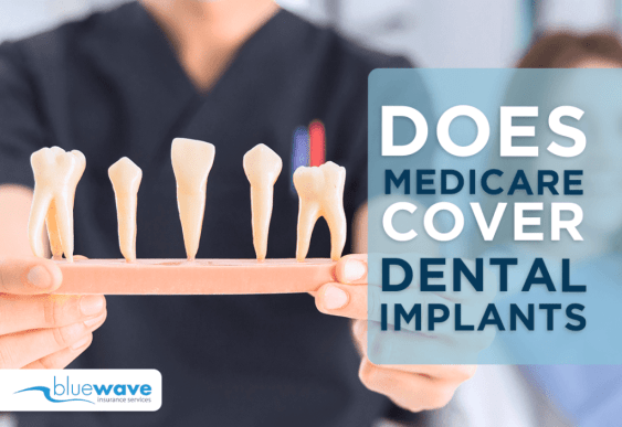 does Medicare cover dental implants?